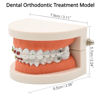 Zobni Ortodontskega Zdravljenja Model s Keramičnimi Nosilec Arch Žice Orto Kovinski Ortodontskega Zobati Zobni Orodja, Zobozdravnik, Laboratorij